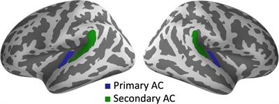 Abnormal phase entrainment of low- and high-gamma-band auditory steady-state responses in schizophrenia